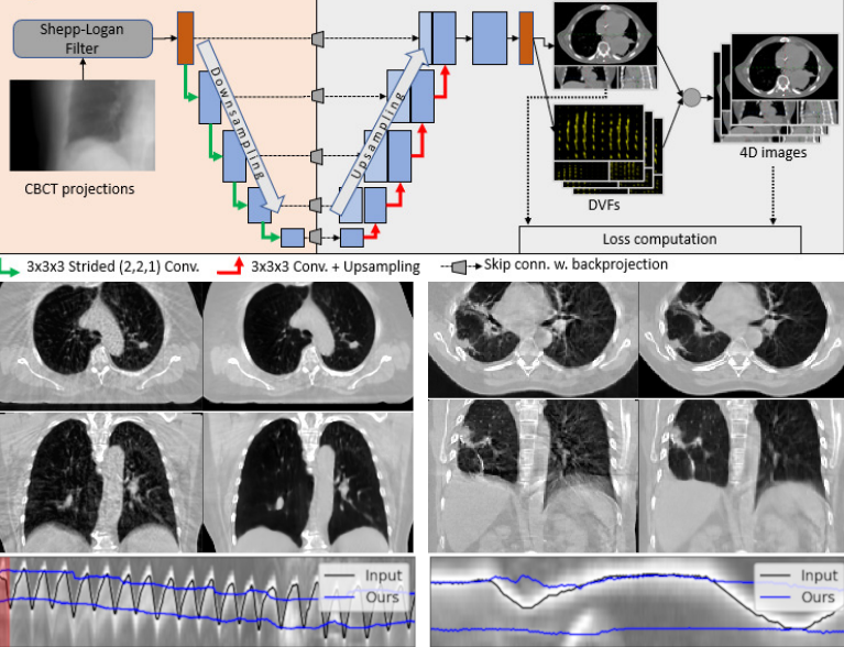 CBCT reconstruction